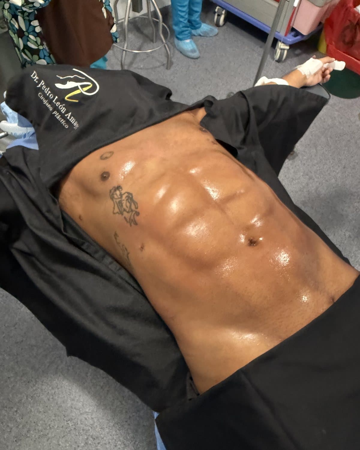 Abdomen masculino con definición muscular tras liposucción HD